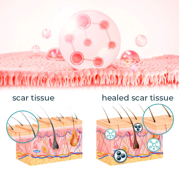 Bioskin Advanced Scar Removal Gel