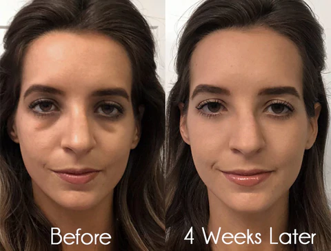 flysmus DEleventh Pro-Xylane Active Eye Cream