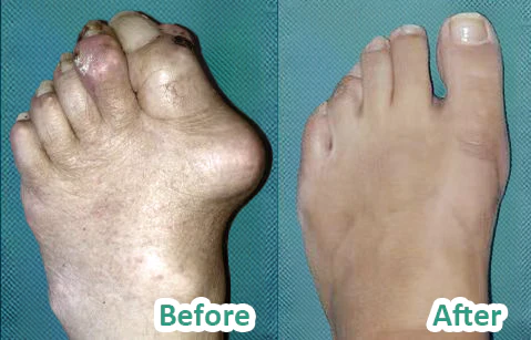 Oveallgo PRO Bee Venom Pain and Bone Healing Cream