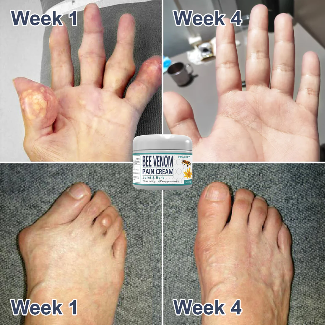 IFMAGIC Bee Venom Pain and Bone Healing Cream