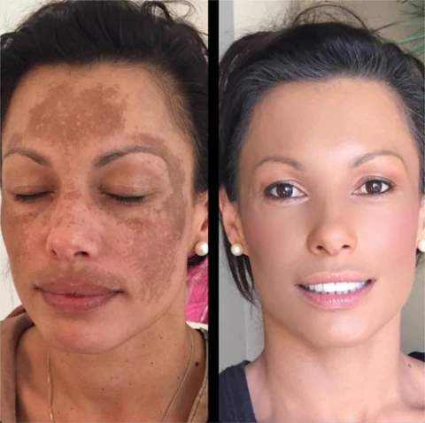 Biancat DermReborn Acne & Dark Spots Cleansing Lotion