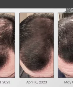Ceoerty Hair Loss Defense Spray