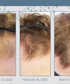 Unpree Root Renew Nourishing Hair Scrub