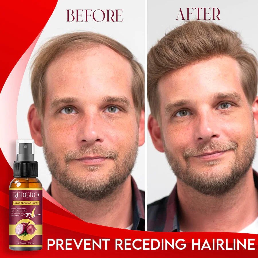 RedGRO Onion Hair Nutrition Spray