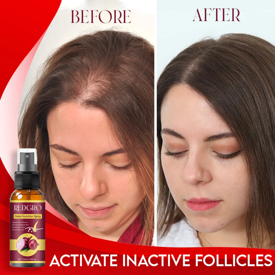 RedGRO Onion Hair Nutrition Spray