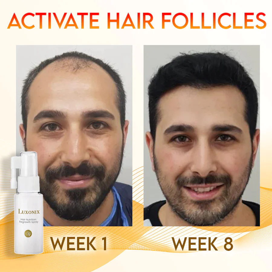 Luxonix Hair Nutrition Regrowth Spray