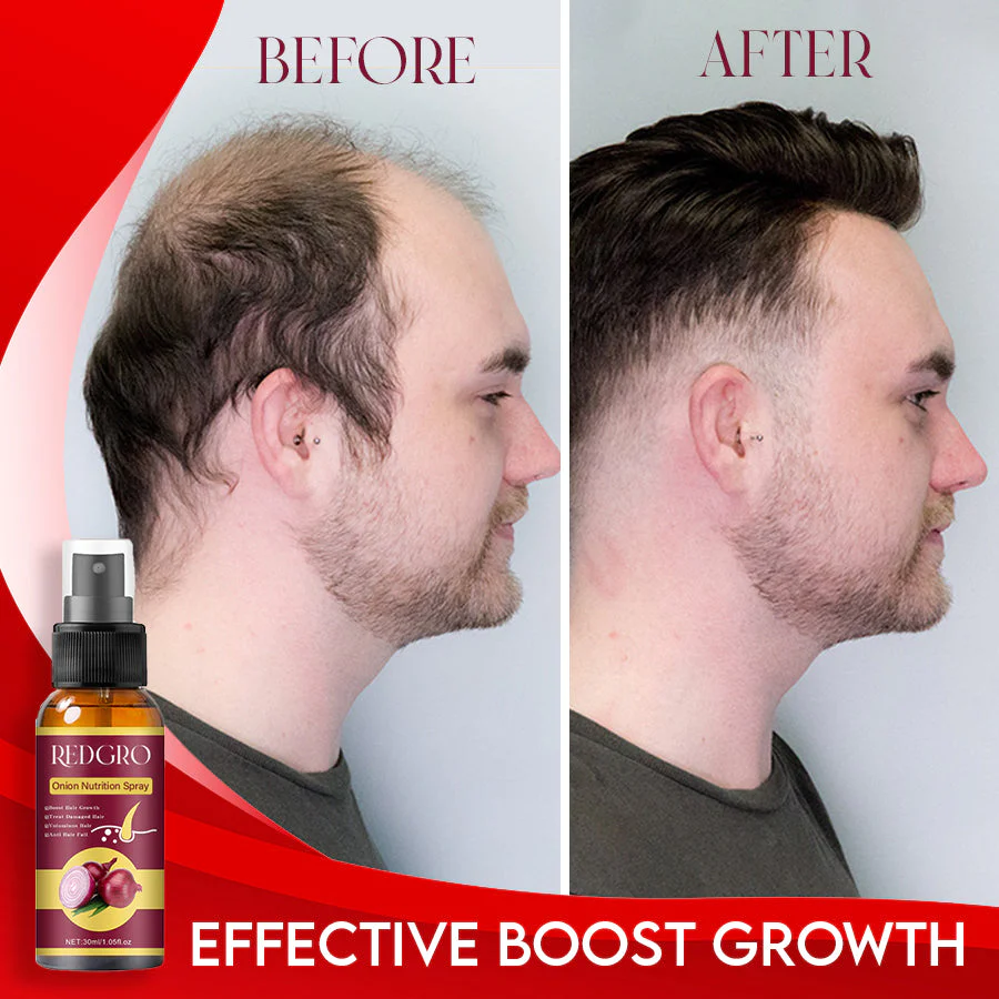 RedGRO Onion Hair Nutrition Spray