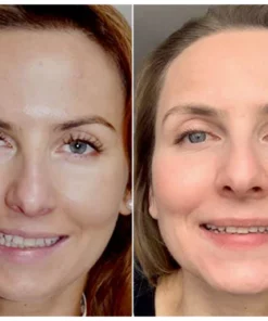 GFOUK EMSculpt Sleeping VFace Beauty Device