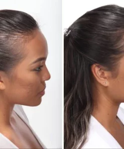 ZeroFall Scalp & Hair Roller Booster