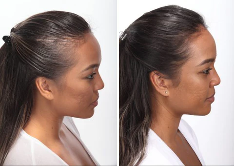 Ceoerty Dense Hair Origin Roller