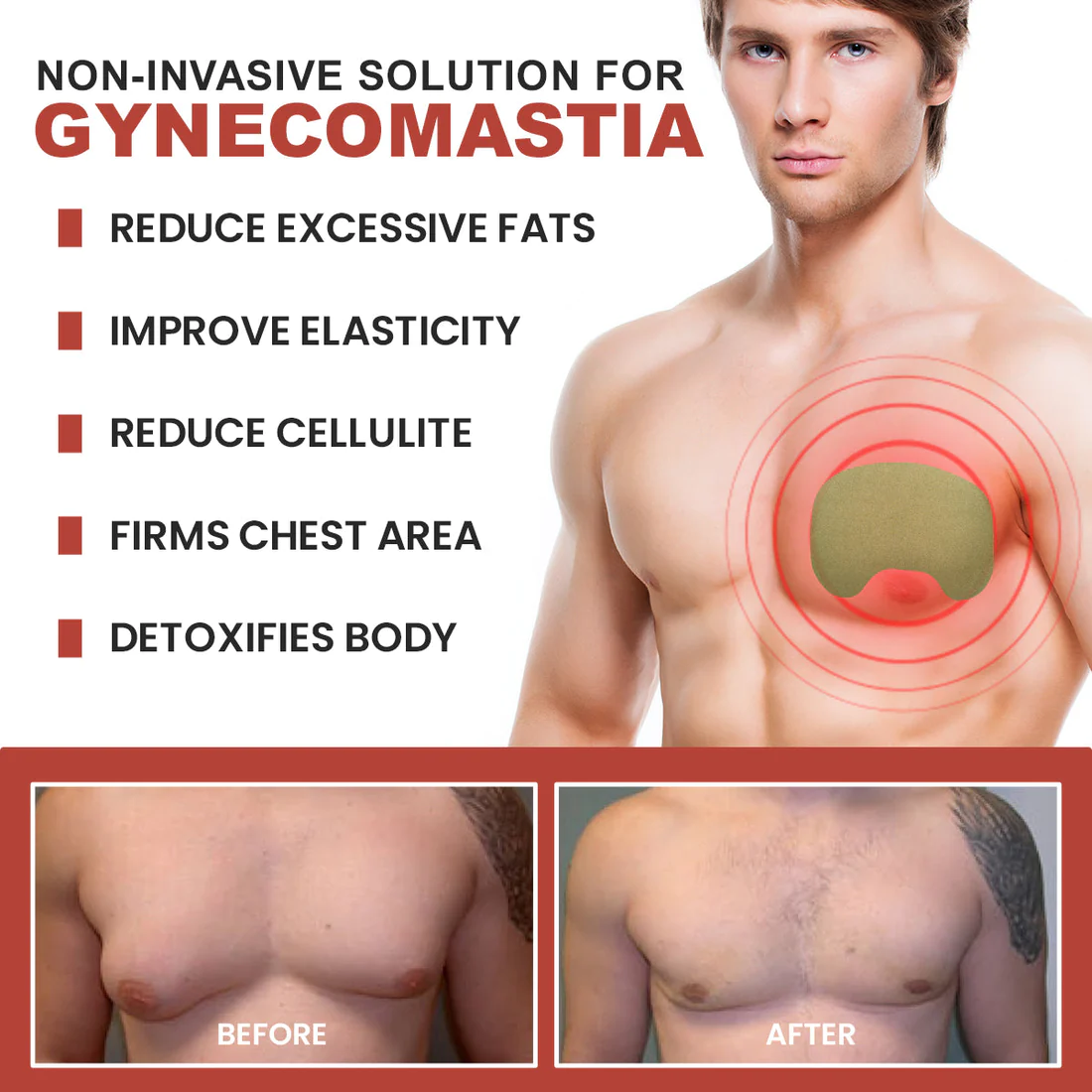 Oveallgo TurmericMax Gynecomastia Compress Patch