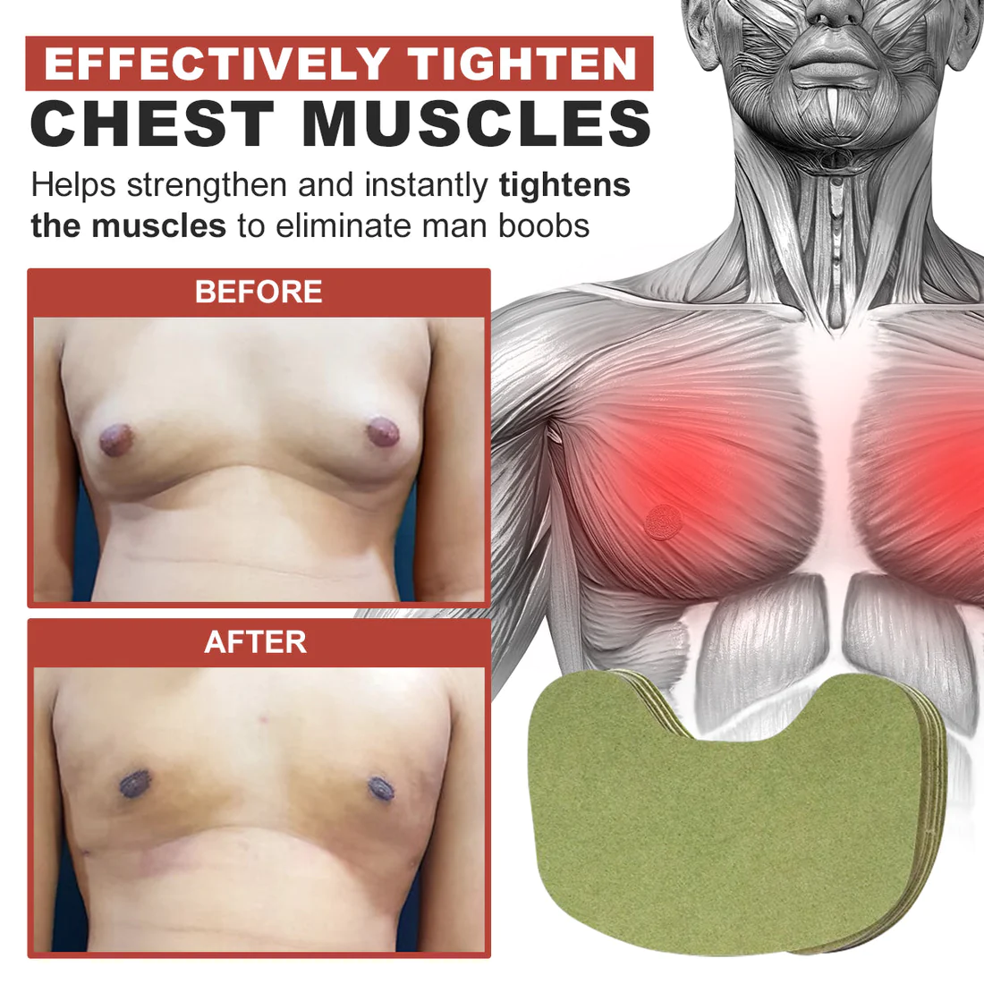 Oveallgo TurmericMax Gynecomastia Compress Patch